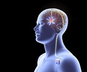 Η νέα επαναστατική μέθοδος της Εγκεφαλικής Νευροδιέγερσης