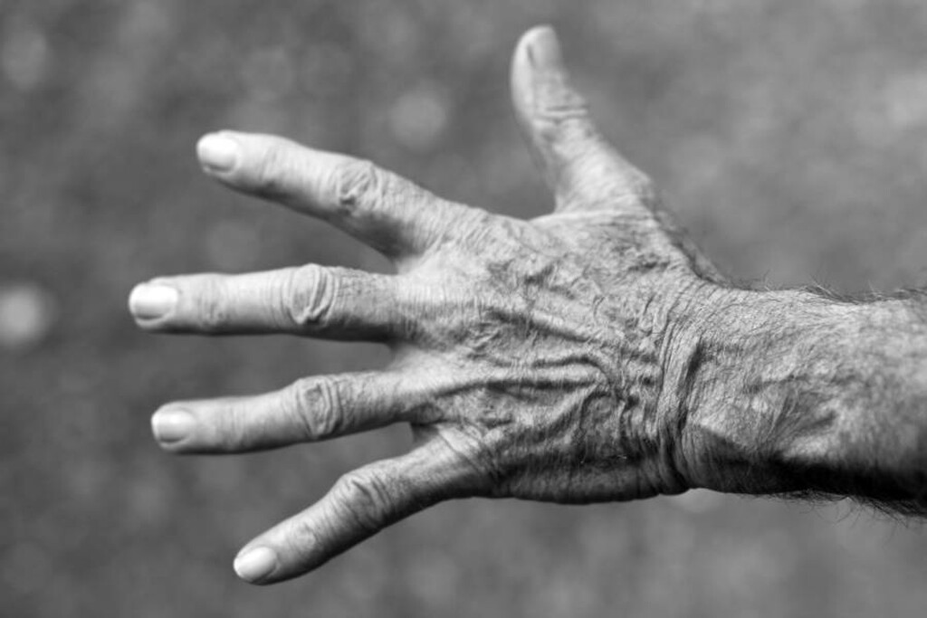 Το σύνδρομο του εξωγήινου χεριού, λοιπόν, είναι τρομακτικό γιατί το χέρι σου κάνει κινήσεις που εσύ δεν θες ή δεν έχεις δώσει εντολή να γίνουν. Πρόκειται για  μια νευρολογική ανωμαλία.