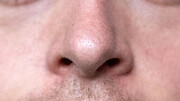 Έχει προληπτικό ρόλο η χρήση ρινικών εκνεφωμάτων φυσιολογικού ορού στη μύτη? | Δεν υπάρχουν στοιχεία που να υποστηρίζουν τέτοιο όφελος.
