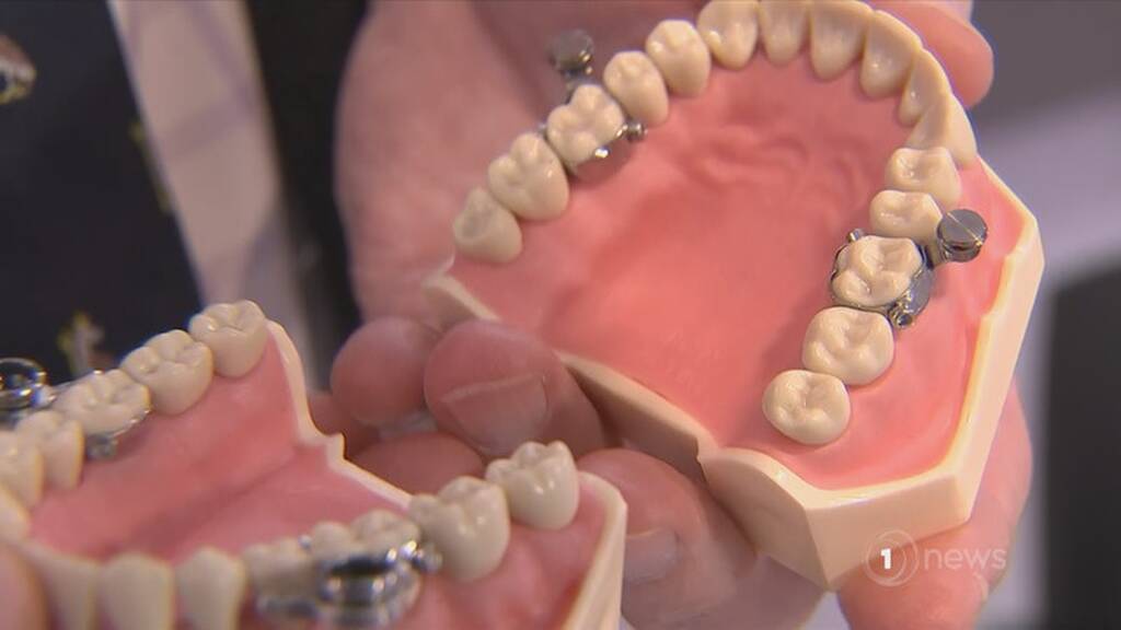 Η συσκευή ονομάζεται DentalSlim Diet Control και επιτρέπει στους χρήστες της να ανοίγουν το στόμα τους σε πλάτος μόνο 2 χιλιοστών.

