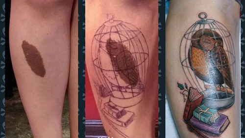 10 ουλές και εκ γενετής σημάδια που μετατράπηκαν σε τατουάζ-αριστουργήματα
