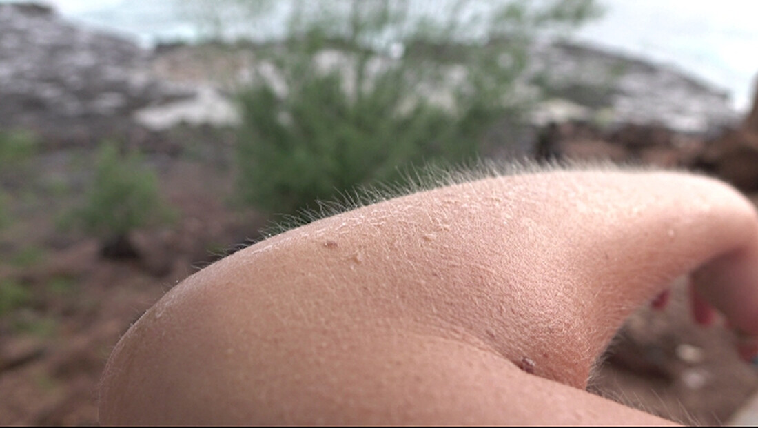 Γιατί ανατριχιάζουμε;