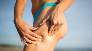 Έχεις αναρωτηθεί ποτέ από πού… περνάει πρώτα η κυτταρίτιδα