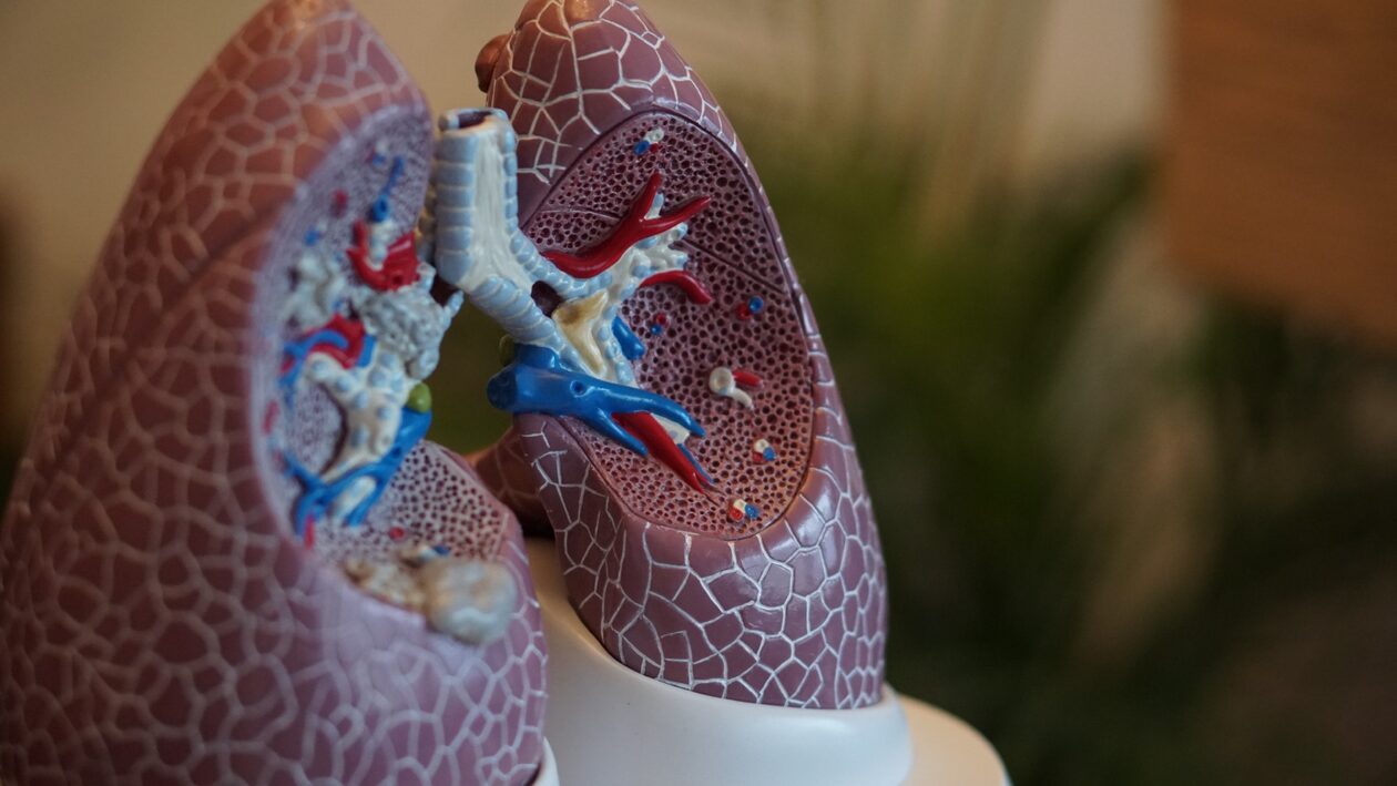Νέο χάπι μειώνει στο μισό τον κίνδυνο θανάτου από καρκίνο του πνεύμονα