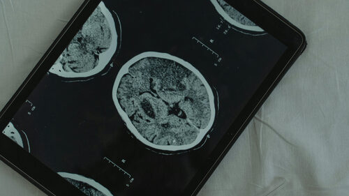 Πώς το ανθρώπινο μυαλό του μέλλοντος θα επηρεάζει την συνείδηση